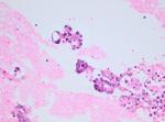 3_case0020MAb.jpg